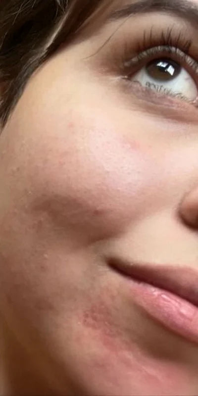 Clearer, glowing skin