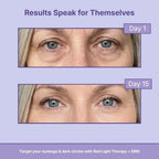 LightUp Under-Eye Shades