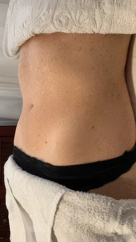 Close-up of a person's lower torso wearing black underwear, with a white towel draped around the waist and hips.
