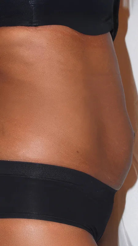 Close-up of a person's lower torso wearing black underwear and a black bra top, with skin visible against a light background.